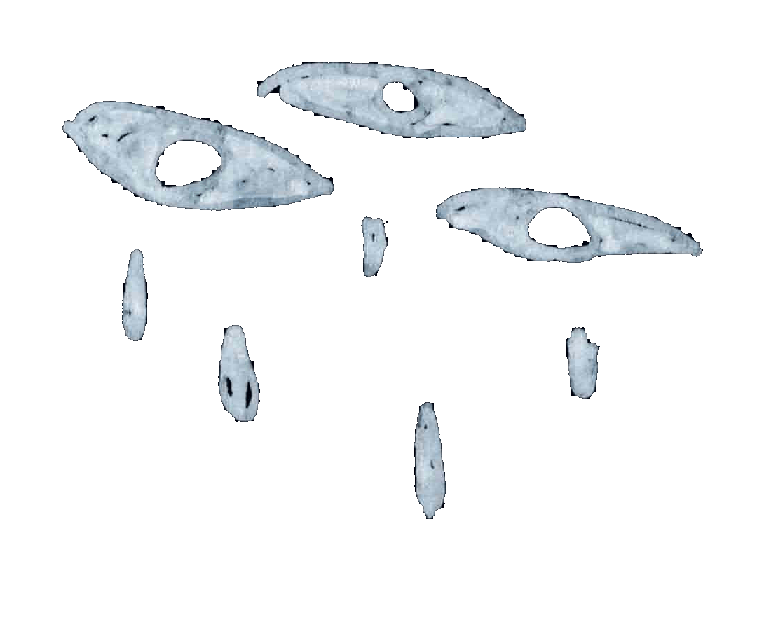 rainy eyes